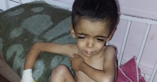 بعد وفاة شقيقه بالمرض ذاته.. ياسر عرفات يصارع سوء التغذية والسيلياك في غزة