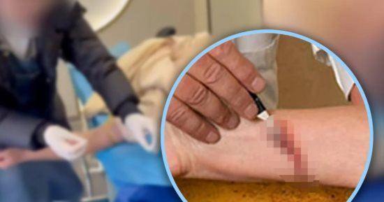 القبض على أطباء صينيين يدعون العلاج بالفصد «الإدماء» لإزالة الطاقة الشريرة