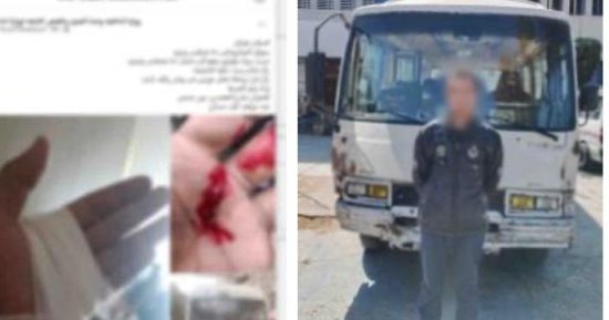 مشادة أولوية المرور تنتهي بدم في عين شمس.. والداخلية تضبط السائق