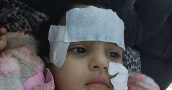 آخر تطورات حادث تعرض طفلة لهجوم أسد بالسيرك القومى فى العجوزة