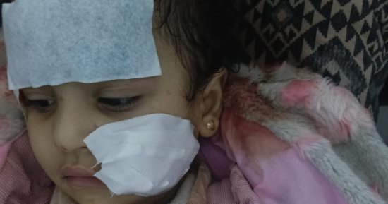 طفلة تتعرض لهجوم من أسد أثناء التقاط صور فى السيرك القومى.. صور 