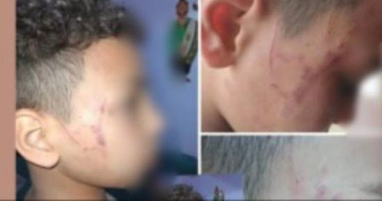 سبّها أمام زملائه فضربته.. كواليس إصابة طالب بخناقة مع معلمته بسوهاج