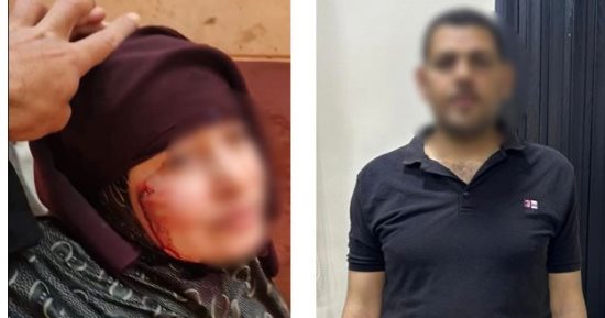 سكين الغدر.. الأمن يضبط زوجاً اعتدى على زوجته وحماته بـ سلاح أبيض