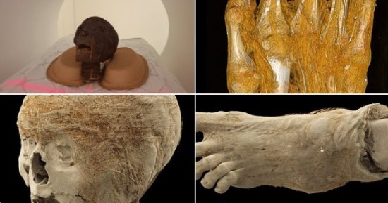 أسرار المومياوات.. كيف تكشف التحاليل الطبية حكايات عاشها القدماء؟