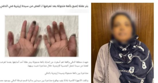 ضبط بائعة جائلة أجنبية قطعت صابع أخرى بسبب الأطفال