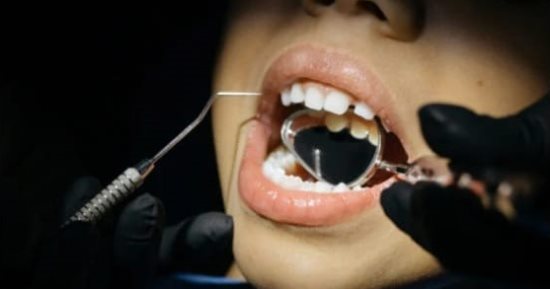 حالة تصيب أسنان ملايين الأطفال تتسبب فى ضعفها وتسوسها.. ما هي وكيف تحدث؟