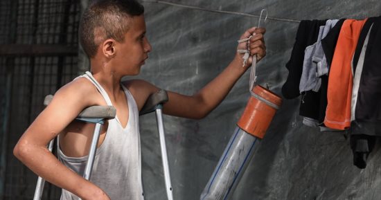 طفل فلسطينى يستعين بـ"ماسورة" لتعويض قدمه المبتورة بسبب القصف الإسرائيلى