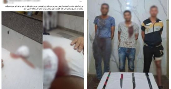 إصابة شخص ببتر بكفه على يد شقيقيه بالبحيرة بسبب الميراث