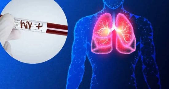 أول عملية زرع رئة فى العالم بين شخصين مصابين بـ الإيدز