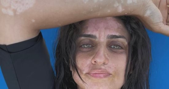 القصة الكاملة لدعم أمير كرارة لشقيقته بعد إصابتها بالبهاق: هو انتي فيه في حلاوتك