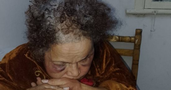 قصة مؤلمة بالسويس.. خلافات أسرية تنتهى باعتداء على الأم