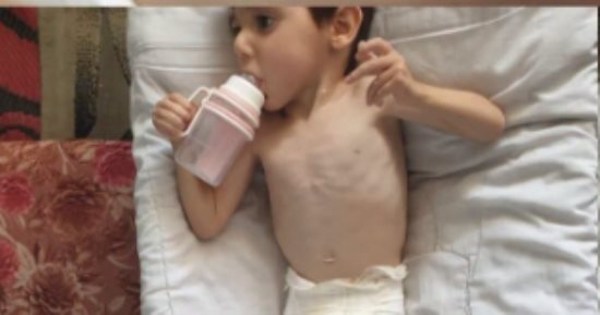 لم يعد يطلب لعبة أو ضحكة.. جسد صغير يصارع الموت.. حكاية زين الهندي داخل مستشفيات غزة.. الطفل يذبل ببطء وجسده يتحول إلى هيكل عظمي لسوء التغذية.. وعدم توافر العلاج داخل القطاع يهدد حياته وسط مناشدات لإنقاذه