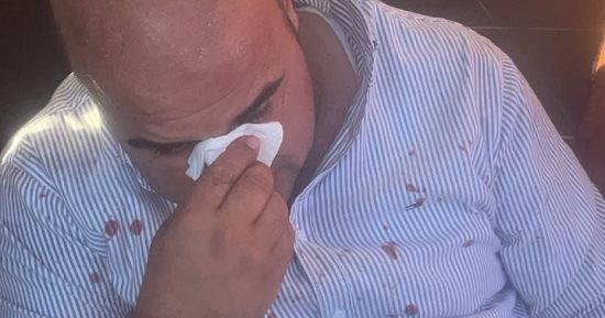 3 سيدات وبائع متجول.. تفاصيل واقعة التعدى على نائب رئيس مدينة رأس البر