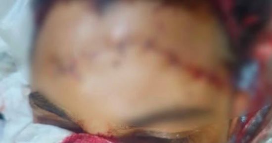الداخلية تكشف ملابسات مشاجرة واصابة مواطنين في المنوفية