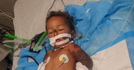 رحل قبل أن يكتمل حلمه.. وفاة الطفل الفلسطيني سند محمد شمعة بعد معاناة مع مرض نادر داخل غزة.. الأطباء بتروا ثلاثة من أطرافه واقترب بتر الطرف الرابع.. نزح مع أسرته إلى خيمة في غزة ولم يمهله الألم فرصة للنجاة