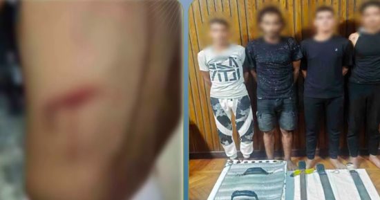 ضبط المتهمين بالتعدي بسلاح على صديقهم بسبب المزاح.. فيديو