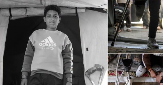 "بين ألم البتر وقسوة النزوح ونقص العلاج".. محمد صليح حكاية طفل من غزة تغيرت حياته في لحظة.. يخوض رحلة يومية من الألم في القطاع وسط تدهور الأوضاع الإنسانية والصحية.. فقد قدمه أثناء الحرب ولم يفقد الأمل