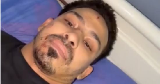 فحص كاميرات المراقبة والاستماع لشهود عيان لكشف ملابسات بتر يد سمكري ببولاق