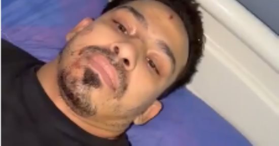التحقيق في واقعة بتر كف سمكري سيارات بصفط اللبن