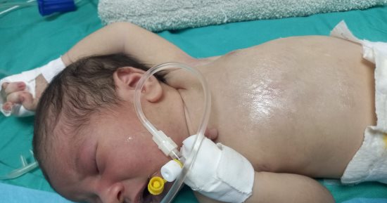 "قلب صغير يصارع من أجل الحياة فى غزة".. الرضيع يحيى أبو طعيمة 21 يوما فقط يواجه تشوهات قلبية معقدة ويحتاج لجراحة عاجلة خارج القطاع.. ووالدته تناشد:"فقدت ابنا من قبل وربنا عوضني بيحيى.. أنقذوه قبل فوات الأوان"