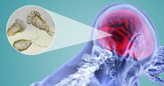 عدوى نادرة.. وفاة مراهقة أمريكية بسبب الأميبا الآكلة للدماغ