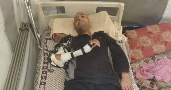 بين ثلاجات الموتى وشفرة البتر.. "محمد خضر" صمود معلق على أمل العلاج خارج غزة.. الأطباء ظنوه شهيدا ووضعوه بين الجثامين فى مستشفى المعمدانى وعائلته لاحظت عدم توقف أنفاسه.. عاد حيا ليواجه معركة جديدة لإنقاذ أطرافه
