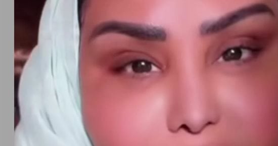 أحلام تظهر بإطلالة جديدة وتثير تفاعل جمهورها بعد تغيير وجهها 