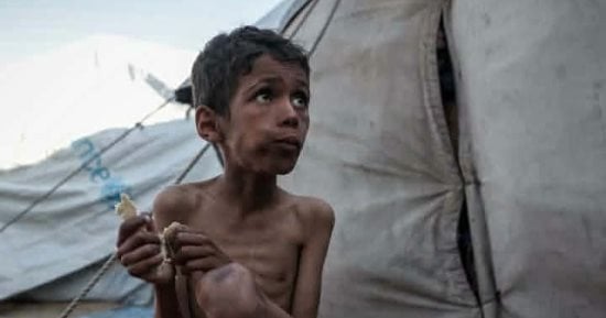 محمد السوسى طفل فقد والده خلال حرب غزة ويواجه الصرع والتشنجات والتأخر العقلى وسوء التغذية.. يحتاج إلى كرسي متحرك وعلاج مستمر.. عمته تكافح لرعايته وشقيقته وسط ظروف معيشية قاسية وتناشد بضرورة علاجه خارج القطاع