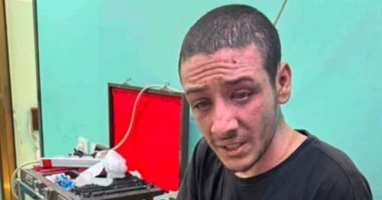 "محيى الدين بلبل" أنهك الألم عينيه وفقد الرؤية فى إحداهما بسبب الحرب على غزة.. يخشى خسارة بصره بالكامل بعدما أصبحت عينه الأخرى بحاجة لعملية عاجلة.. ويناشد الإسراع في علاجه قبل تحول خوفه من فقدان البصر إلى واقع