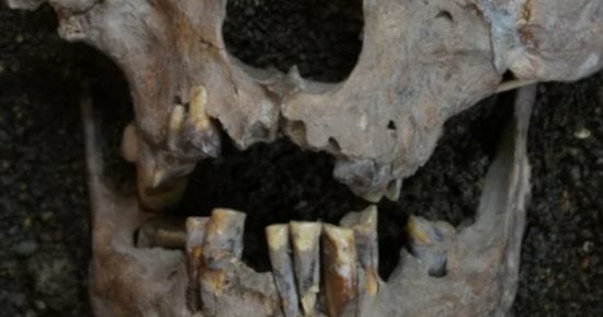 قبل 25 ألف عام.. بشر ما قبل التاريخ استخدموا "الجوز" كمخدر للأسنان.. صور