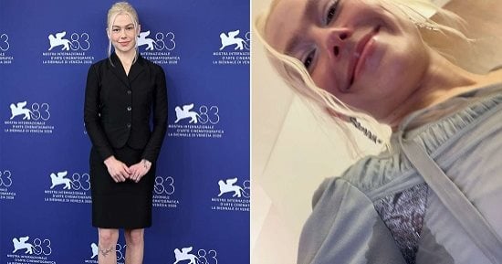 بعد إطلالة فيبى بريدجرز المثيرة للجدل.. هل تتغير نظرة النساء لإزالة الشعر؟