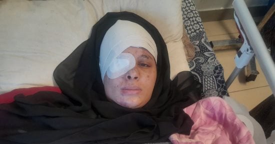 من تحت ركام ميناء الصيادين في غزة.. دينا مقداد تروي شهادة صمود بين بتر الأطراف وجراح الرأس.. فقدت زوجها ونصف وجهها بقصف إسرائيلي.. ترقد في مجمع الشفاء بين جراح المخ وبتر اليد.. وتستغيث لمنحها أمل العلاج بالخارج