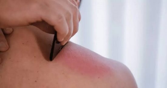 من فروة الرأس للظهر.. ترند الخربشة تجربة غير تقليدية للتخلص من التوتر
