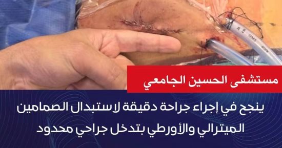 مستشفى الحسين الجامعي ينجح في إجراء جراحة دقيقة لاستبدال الصمامين الميترالي والأورطي بتدخل جراحي محدود