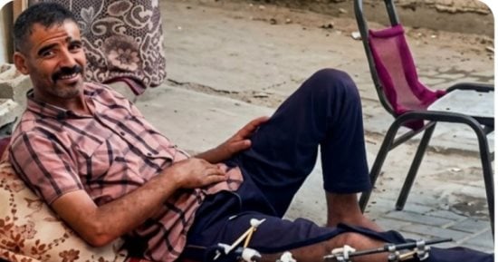 نجا من قصف إسرائيلى لخيام النازحين بغزة أسفر عن 12 شهيدا.. الفلسطينى محمود أبو ندى خرج من الحرب بجسد مثقل بإصابات في الرأس والصدر واليد والقدم.. وينتظر السفر لإجراء زراعة جمجمة وعظم في قدمه واستكمال رحلة العلاج