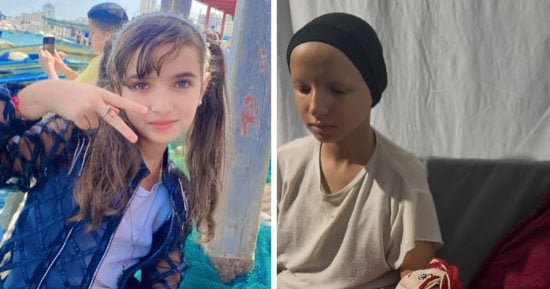 "شو ذنبى إنى فقدت شعرى؟".. سنا رضوان طفلة فلسطينية فى الـ12 من عمرها تواجه الثعلبة والتنمر في ظل الحرب.. نزحت أكثر من 15 مرة تحت القصف داخل غزة.. فقدت شعرها بالكامل وتنتظر العلاج خارج القطاع والعودة إلى طفولتها