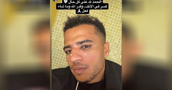 مساحات سبورت : أحمد ربيع يعلن إصابته بكسر فى الأنف بعد مباراة الزمالك والجيش الرواندي