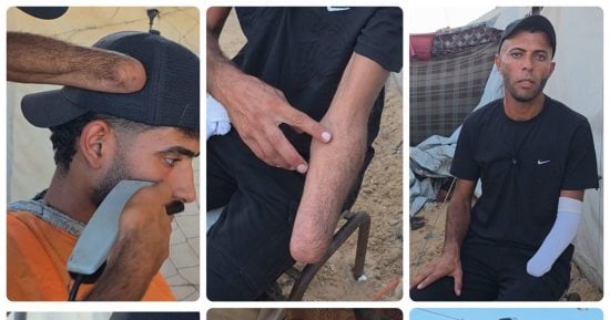 "بيد واحدة يتمسك بالحياة".. جهاد المبحوح يحارب قسوة الحرب بمقص الحلاقة ويكسب رزقه بكرامة.. يتحدى ألم الإصابة وقسوة الظروف داخل غزة.. وآلاف مبتوري الأطراف ينتظرون برامج تأهيل تعيد إليهم بعضا من استقلالهم