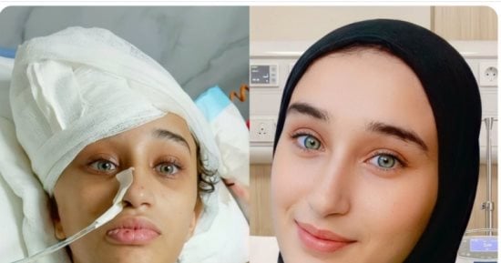 نفسى أصحى من النوم وأسمع بنتي تناديني ماما.. عام وبتول المشهراوي ترقد في غيبوبة بعد إصابتها بقصف إسرائيلي في رأسها.. الأم معلقة بين وجع الانتظار وأمل النجاة وتناشد العالم إخراج ابنتها من غزة وتأمين العلاج لها