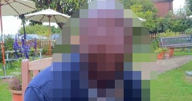 ديلى ميل: استئصال رحم لرجل تنزل دماء الدورة الشهرية فى بوله