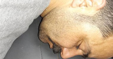 بالصور.. إصابة موظف بطعن غائر فى الظهر بسبب خلافات عائلية