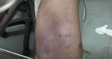 انتحار فكهانى بسبب مروره بأزمة نفسية بعد طلاقه لزوجته فى الدقهلية