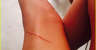تايلور سويفت تمازح قطتها بعد جرحها فى ساقها: مديونة لى بـ 40مليون دولار