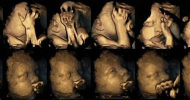 مشرعون بأوهايو يوافقون على قطع المعونة عن منظمة للصحة الإنجابية فى أمريكا