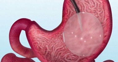 عشان تحافظ على حالتك المزاجية ..تناول المكسرات والسمك