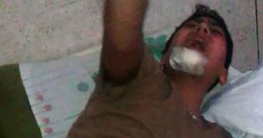 صحافة المواطن.. بالصور: مواطنة تستغيث لعلاج نجلها إثر تعرضه لحادث مأساوى بالمنصورة