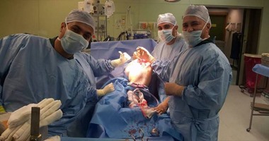 بالصور.. فريق طبى بمستشفى جامعة القناة يجرى جراحة نادرة لتركيب مفصل لفتاة