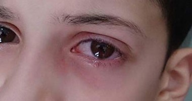 صحافة المواطن: قارئ يشتكى التعدى على نجله فى إحدى مدارس شبرا الخيمة