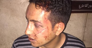 فى قضية ضابط الألف مسكن المتهم بإصابة سائق بسلاحه الميرى.. محامى الضابط يطالب بعرضه موكله على الطب الشرعى والنيابة تستجيب.. والتقرير المبدئى للمتهم: كدمات فى العينين وجرح طولى بالعين