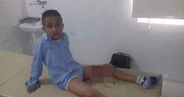 كلب ضال يعقر طفلا أثناء ذهابه للمدرسة بسفاجا
